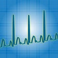 Free Heartbeat Blue Royalty Free Stock Photos - 1355148
