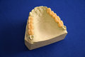 Free Oral Health Teeth Mold Royalty Free Stock Photo - 1422405
