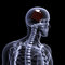 Free Skeleton X-Ray - Cake Stock Photo - 2032750