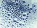 Free Odd Bubbly Moldy Blue Texture Stock Photos - 2092923