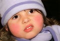 Free Rosy Cheeks Stock Images - 3066054