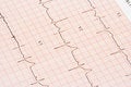 Free EKG Chart Royalty Free Stock Images - 3638039