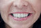 Free Big Smile Stock Photo - 5891490