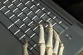 Free Skeletal Hands Royalty Free Stock Photo - 82755