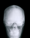 Free X-ray Skull Stock Image - 8594771