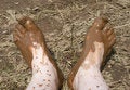 Free Dirty Feet Stock Images - 8901184