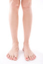 Free Ugly Feet. Royalty Free Stock Photos - 9080818