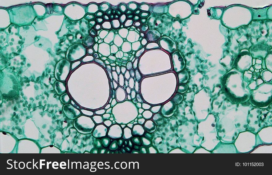 cross section:Zea leaf common name: corn magnification: 400x The iso-bilateral leaf of Zea is typical of most monocots. Both upper and lower epidermis are uniseriate and well cutinized. Within the upper, or adaxial, epidermis, large white bulliform cells shrink, allowing the leaf to roll during drought. Stomata are present on both surfaces with guard cells perched above small round substomatal chambers. As with most monocots the mesophyll is unspecialized, being composed of compactly arranged somewhat round chlorenchyma cells. Numerous small and occasionally large vascular bundles are arranged in parallel series along the length of the leaf. The vascular bundles are collateral and closed with xylem of vessels and tracheids towards the adaxial surface and phloem of sieve tubes and companion cells towards the abaxial surface. Cambium is not present. Within each bundle a xylem of two oval metaxylem and a single large protoxylem cavity can be seen. Each vascular bundle is wraped by a bundle sheath of thin walled parenchyma cells. Larger bundles are supported towards both surfaces by masses of sclerenchyma that interrupt the mesophyll to form a patchy hypodermis. cross section:Zea leaf common name: corn magnification: 400x The iso-bilateral leaf of Zea is typical of most monocots. Both upper and lower epidermis are uniseriate and well cutinized. Within the upper, or adaxial, epidermis, large white bulliform cells shrink, allowing the leaf to roll during drought. Stomata are present on both surfaces with guard cells perched above small round substomatal chambers. As with most monocots the mesophyll is unspecialized, being composed of compactly arranged somewhat round chlorenchyma cells. Numerous small and occasionally large vascular bundles are arranged in parallel series along the length of the leaf. The vascular bundles are collateral and closed with xylem of vessels and tracheids towards the adaxial surface and phloem of sieve tubes and companion cells towards the abaxial surface. Cambium is not present. Within each bundle a xylem of two oval metaxylem and a single large protoxylem cavity can be seen. Each vascular bundle is wraped by a bundle sheath of thin walled parenchyma cells. Larger bundles are supported towards both surfaces by masses of sclerenchyma that interrupt the mesophyll to form a patchy hypodermis.