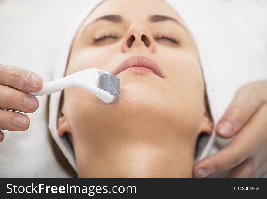 Roller Microneedle Mesotherapy. Portrait of a young woman. Roller Microneedle Mesotherapy. Portrait of a young woman