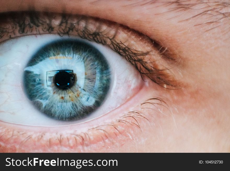 Person With Teal and Yellow Left Eye