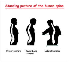 Standing Posture Of The Black Human Spine. Defects Of The Human Spine. Correct Alignment Of Human Body In Standing Posture. Royalty Free Stock Photography