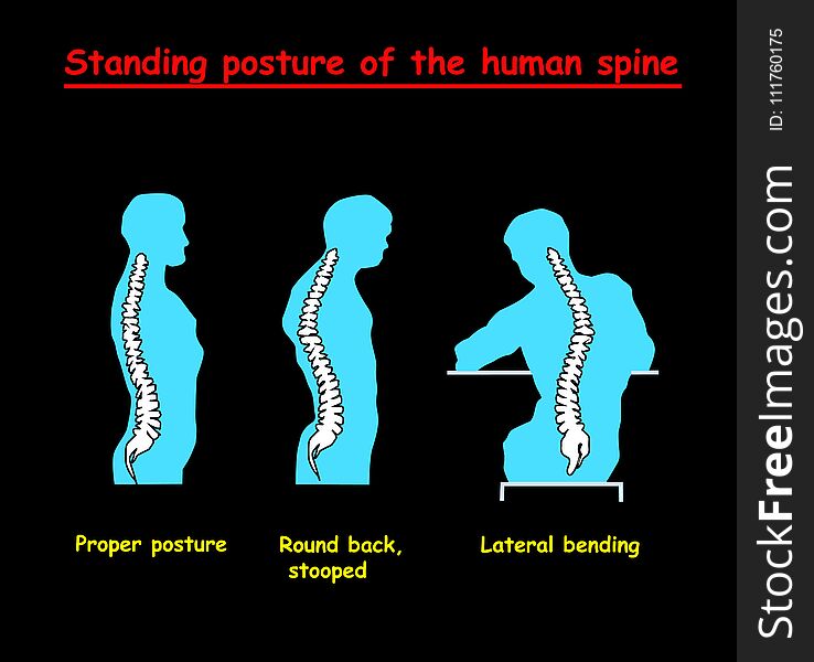 Standing posture of the blue human spine. Defects of the human spine. Correct alignment of human body in standing posture.
