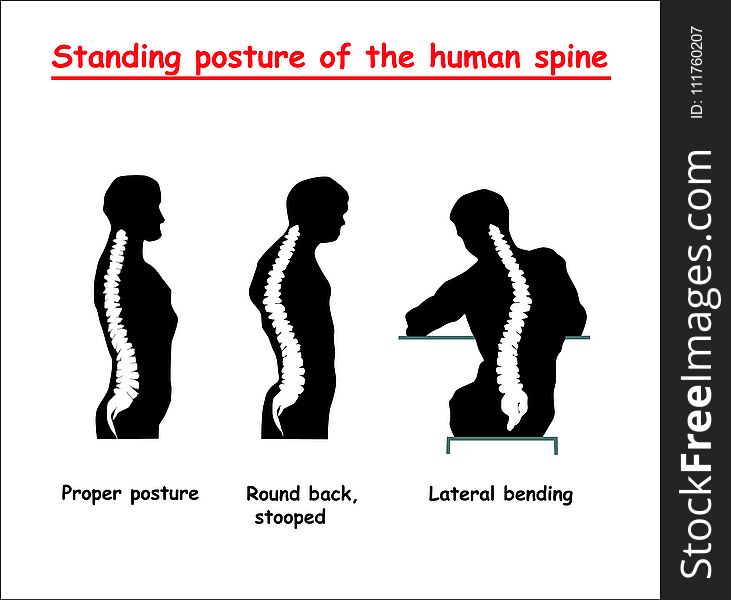 Standing Posture Of The Black Human Spine. Defects Of The Human Spine. Correct Alignment Of Human Body In Standing Posture.