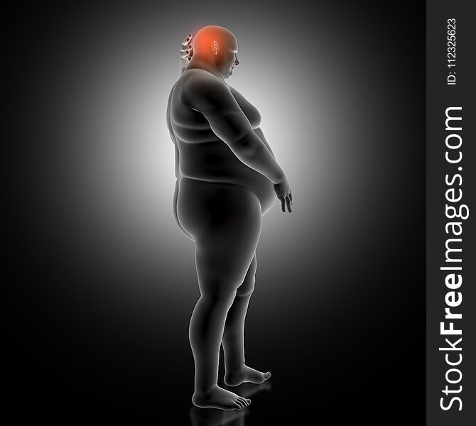 3D medical background with overweight man holding head in pain