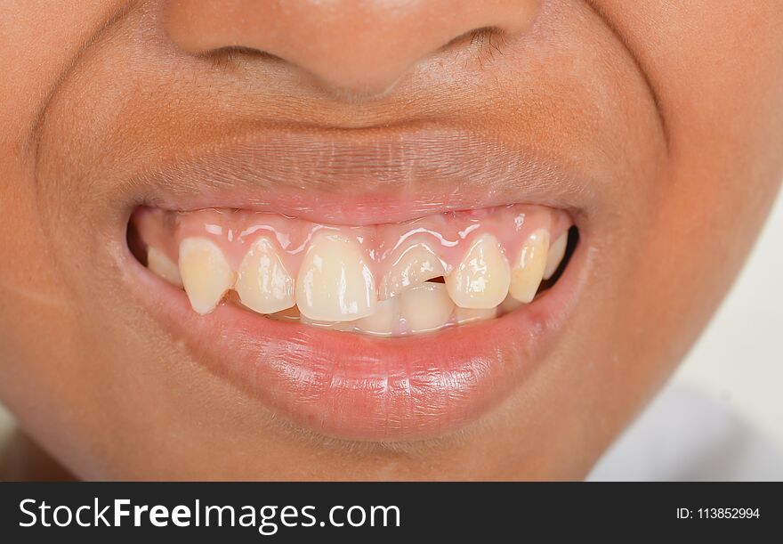 76+ Children healthy teeth Free Stock Photos - StockFreeImages