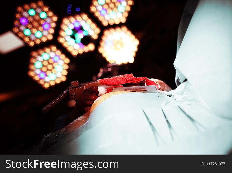 Daunting light of an operating lamp associated with the phobia of a surgical procedure.