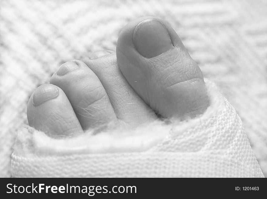 Four toes sticking out of the cast. Black and white. Shallow Depth of Field. Four toes sticking out of the cast. Black and white. Shallow Depth of Field.