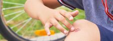 Boy With A Scraped Knee Outdoor. Wound On Boy Knee After Accident. Royalty Free Stock Photo