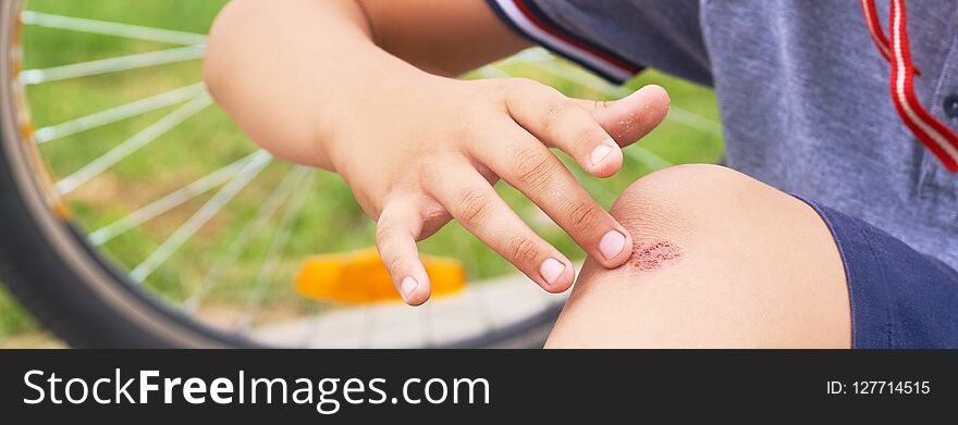 Boy With A Scraped Knee Outdoor. Wound On Boy Knee After Accident.