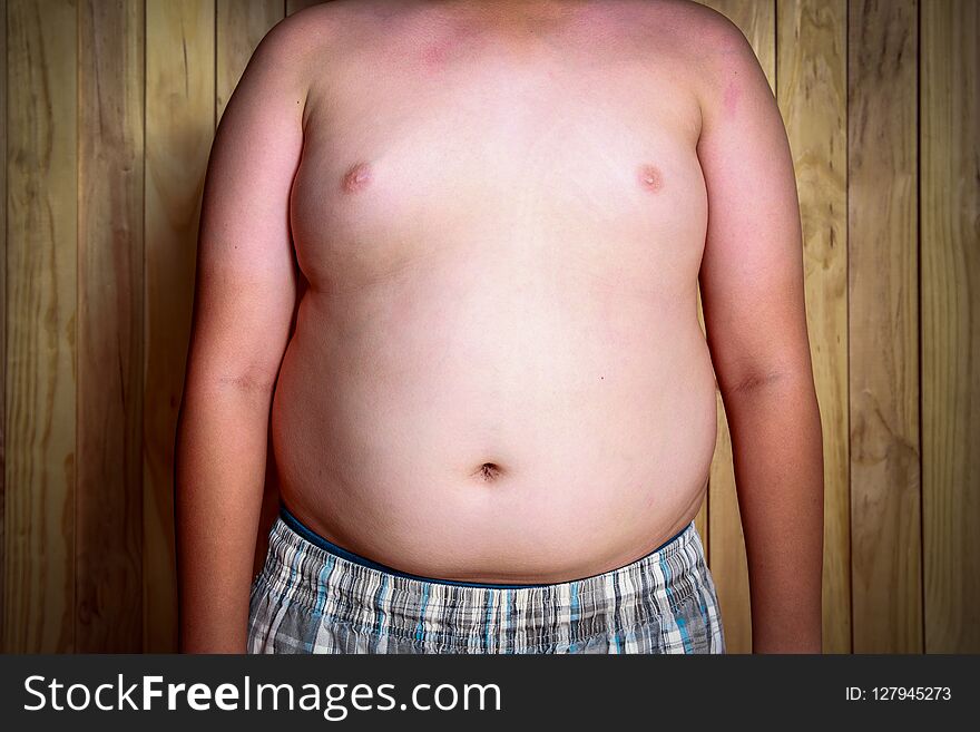 The Size Of Stomach Of Children With Overweight.