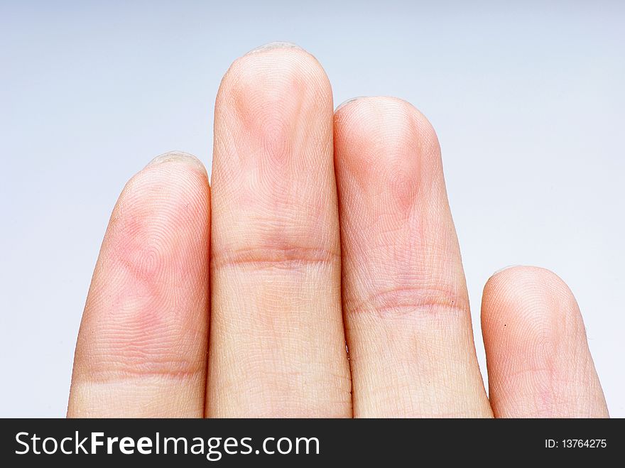 Finger