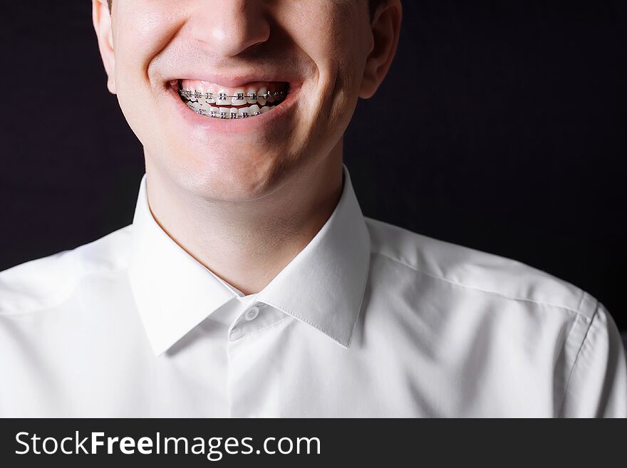 Portrait Of A Man Of Caucasian Appearance In Orthodontic Braces, Metal Brackets On His Teeth In A White Shirt On A Black