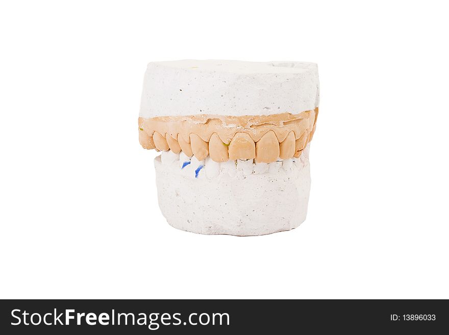 Series. teeth plaster cast. Close up on white background