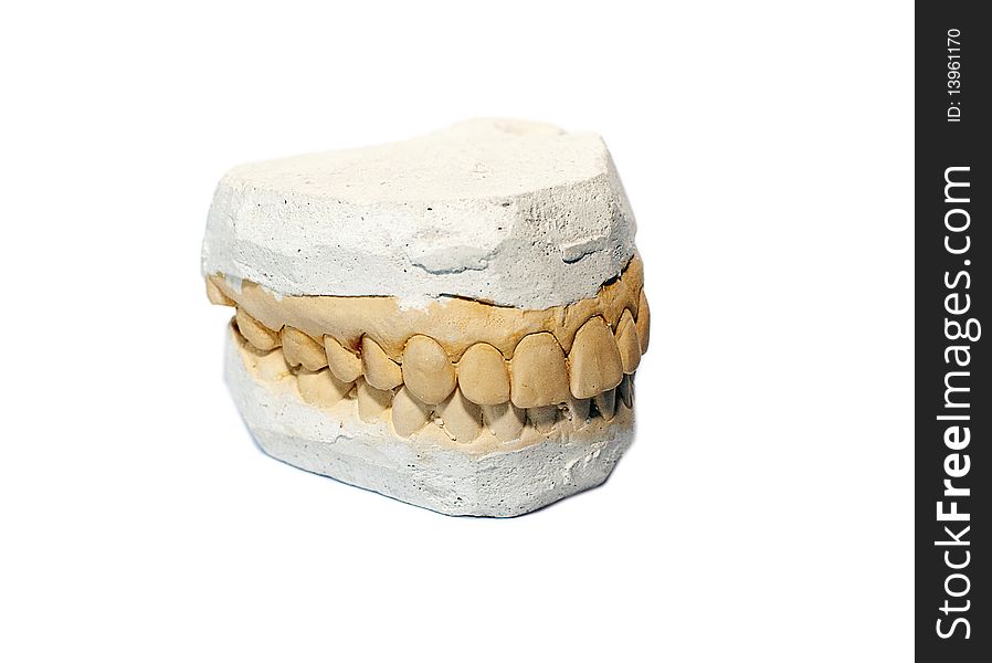 False plaster teeth for prosthesis white background