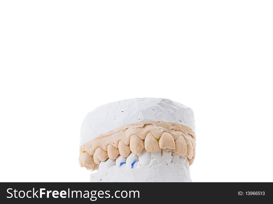 Series. teeth plaster cast. Close up on white background