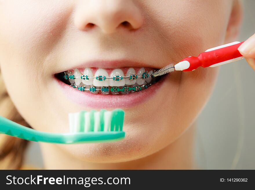 Dentist and orthodontist concept. Young woman with blue braces cleaning and brushing teeth using two different brushes, little interdental brush and manual toothbrush. Dentist and orthodontist concept. Young woman with blue braces cleaning and brushing teeth using two different brushes, little interdental brush and manual toothbrush