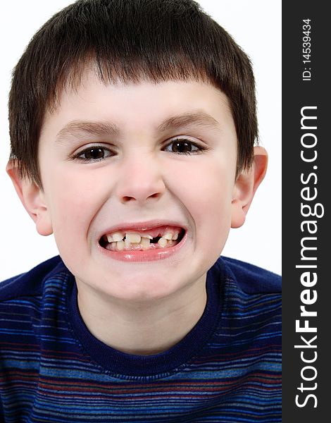 Young boy grimacing and showing off his missing milk tooth