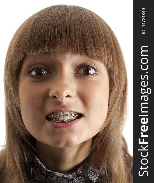 Girl smiles with bracket on teeth