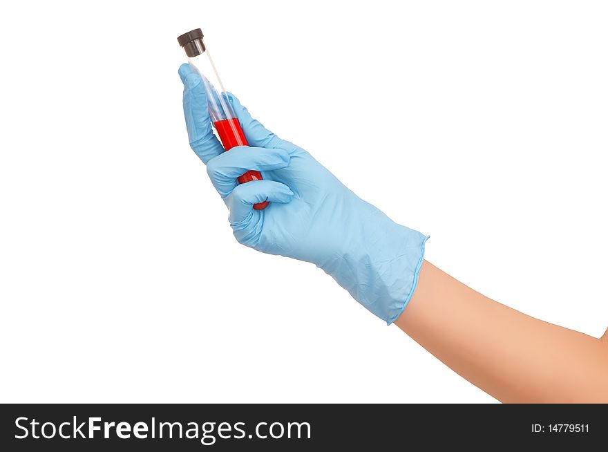 Doctor picked up a tube with probe of good blood. Doctor picked up a tube with probe of good blood