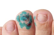 Injured Foot Finger Stock Photos Injured Foot Finger Stock Photos