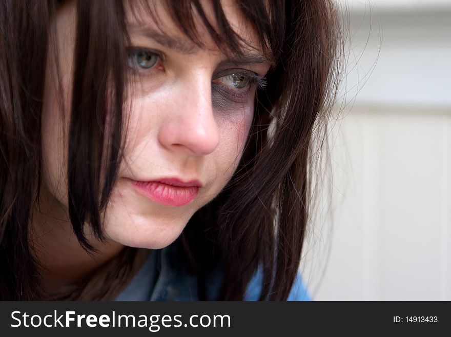 Young Woman With Black-eye Crying