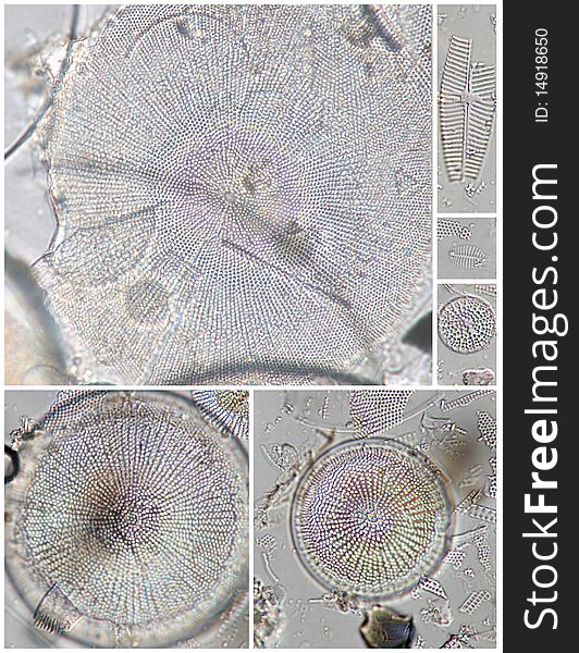 Diatoms - Stephanodiscus And Other Spp.
