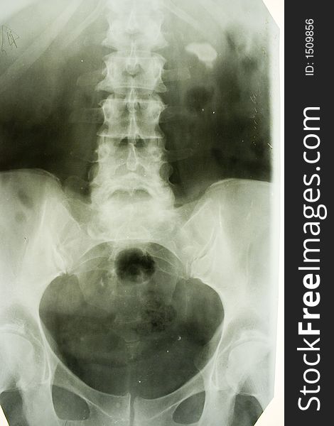 X-ray picture of human trunk in front