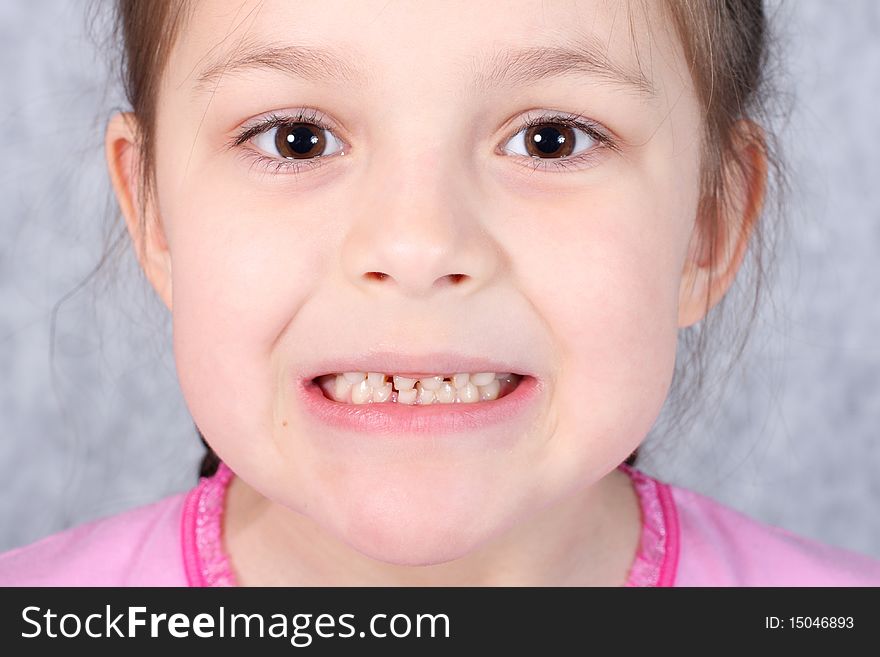 Girl grimacing, showing off his first missing milk tooth. Girl grimacing, showing off his first missing milk tooth