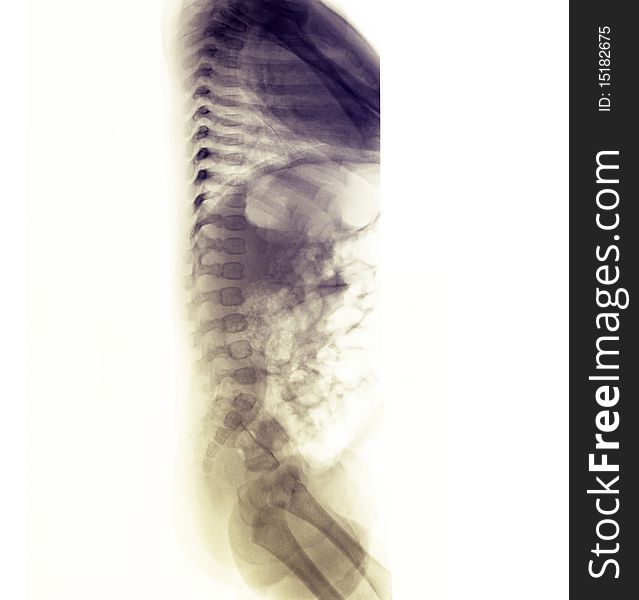 X-ray of a 3 month old female showing a lateral view of the spine.  Normal anatomy.