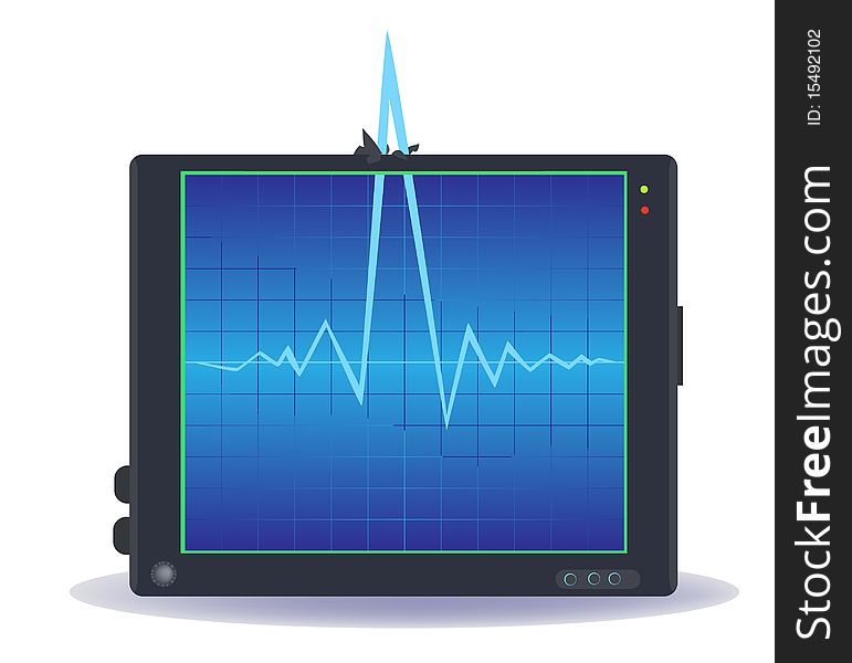 The device for measurement of rhythms of work of heart. The device for measurement of rhythms of work of heart