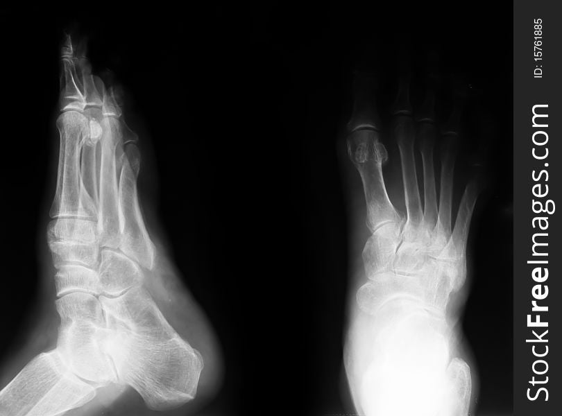 Detail of x-ray image : human feet. Detail of x-ray image : human feet