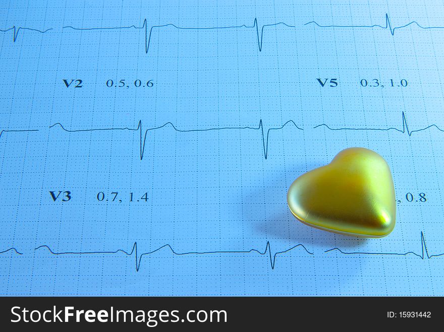 Golden heart on blue EKG printout