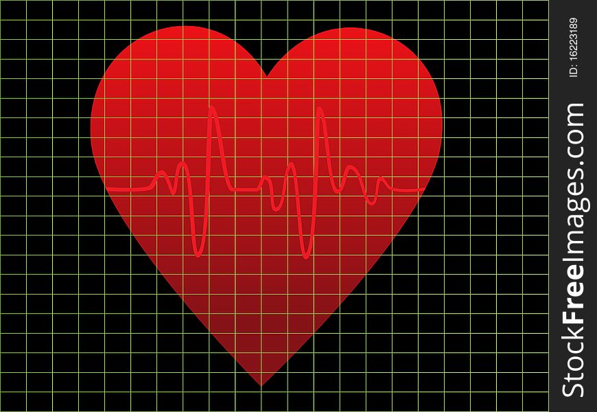 EKG Or Heart Monitor