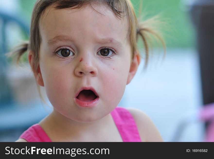 Close up of a little girl with a scratch on her nose. Close up of a little girl with a scratch on her nose