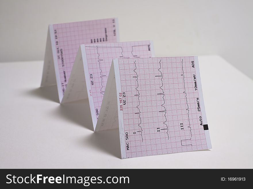 Photo of real electrocardiogram graph