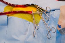 Surgery Royalty Free Stock Photos Surgery Royalty Free Stock Photos