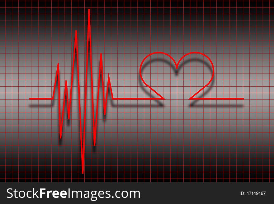 Illustration of an electrocardiogram (ECG)