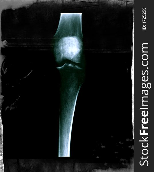 X-Ray Leg