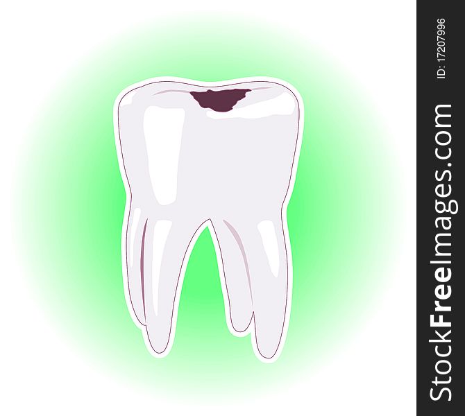 Tooth with cavity or dental filling illustration isolated on white green background