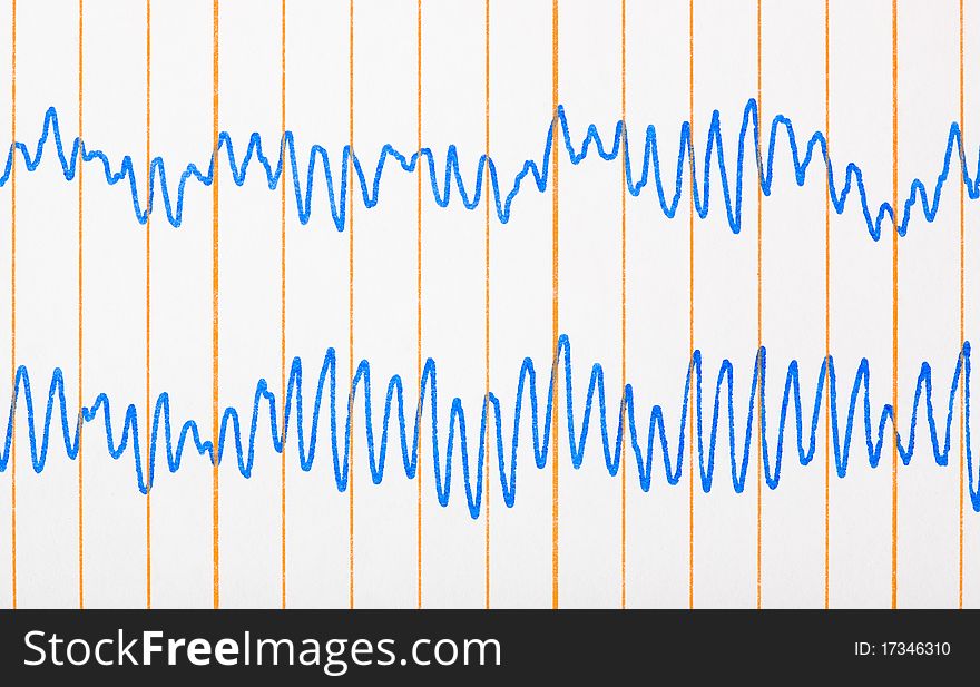 Electro cardiogram ecg - medical background. Electro cardiogram ecg - medical background